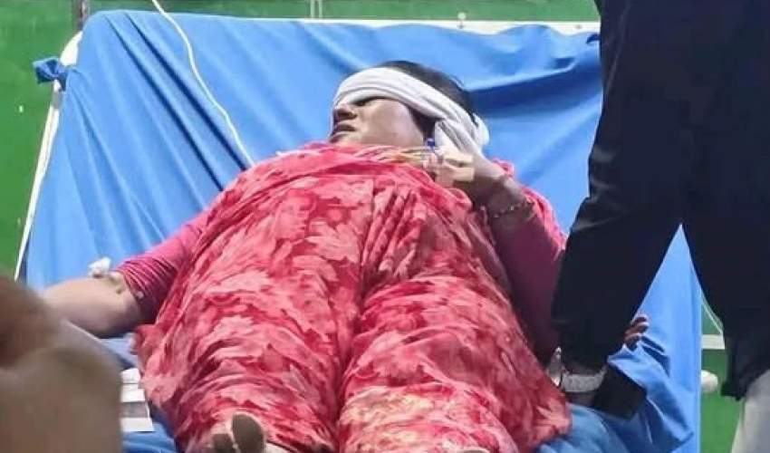 कञ्चनपुरको बेलडाँडी गाउँपालिका उपाध्यक्ष नाथ ज्यानसम्बन्धी मुद्दामा पक्राउ